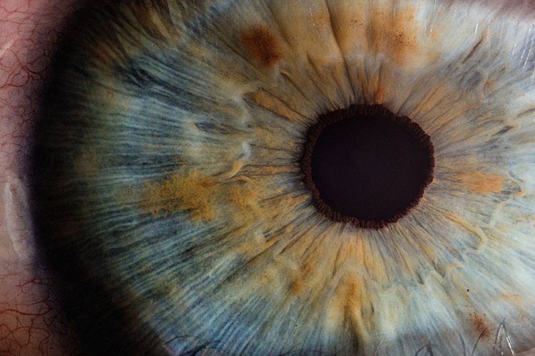 تفاوت چشم انسان با دوربین عکاسی دیجیتال